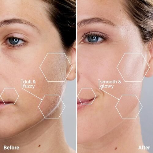 Facial Hair Removal for Women - Painless Facial Hair Remover - Electric Hair Removal Device for Face Lips Peach Fuzz with Light (Rose Gold) - Image 4