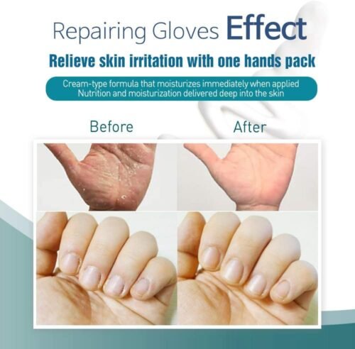 Epielle Intensive Repairing Hand Masks 6 Pairs, Deep Moisturizing Gloves for Dry, Cracked Hands, Repair with Coconut Oil & Milk Extract, Korean Skin Care, Spa Set, Self Care Gifts for Women - Image 9